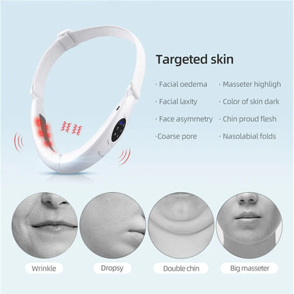 Transform Your Skin with the Ckeyin V-Shaped Facial Lifting Device - Advanced Red Light Therapy for a Slimmer, Youthful Face and Neck